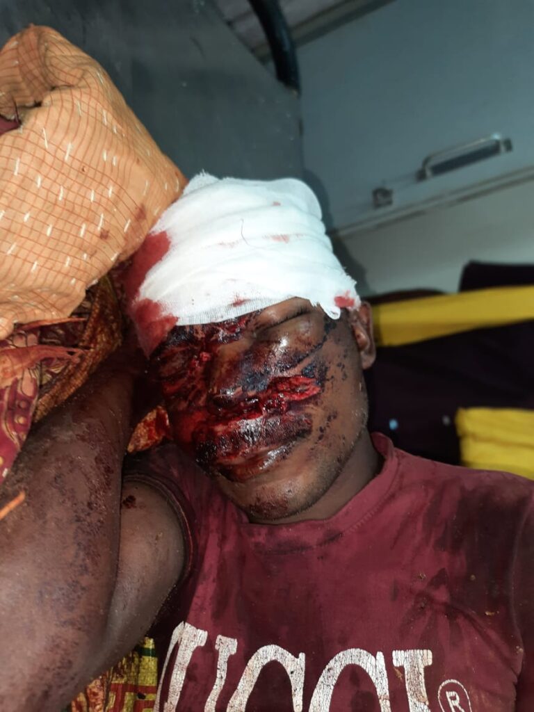 भालू के हमले से रामनगर निवासी घुनेश्वर घायल हो गया है । उदयपुर सामुदायिक स्वास्थ्य केंद्र में प्राथमिक उपचार के